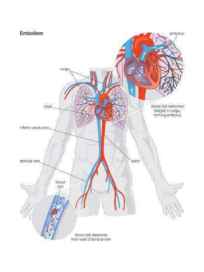 Poster, , large