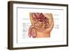 Enlarged Prostrate Gland, Illustration-Gwen Shockey-Framed Art Print