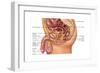 Enlarged Prostrate Gland, Illustration-Gwen Shockey-Framed Art Print