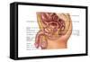 Enlarged Prostrate Gland, Illustration-Gwen Shockey-Framed Stretched Canvas