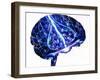 Epilepsy-John Bavosi-Framed Photographic Print