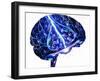 Epilepsy-John Bavosi-Framed Photographic Print