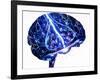 Epilepsy-John Bavosi-Framed Photographic Print