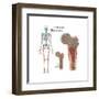 Ewings Sarcoma Locations on the Skeleton-null-Framed Art Print