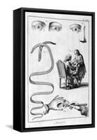Eye Surgery, 1751-1777-Denis Diderot-Framed Stretched Canvas