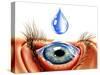 Eye with Conjunctivitis-John Bavosi-Stretched Canvas