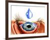 Eye with Conjunctivitis-John Bavosi-Framed Photographic Print