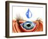 Eye with Conjunctivitis-John Bavosi-Framed Photographic Print