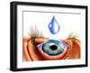 Eye with Conjunctivitis-John Bavosi-Framed Photographic Print