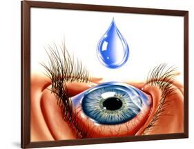 Eye with Conjunctivitis-John Bavosi-Framed Photographic Print