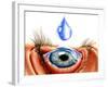 Eye with Conjunctivitis-John Bavosi-Framed Photographic Print