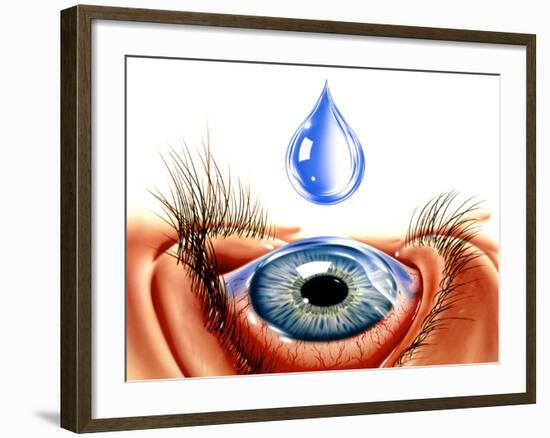 Eye with Conjunctivitis-John Bavosi-Framed Photographic Print