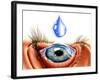 Eye with Conjunctivitis-John Bavosi-Framed Photographic Print