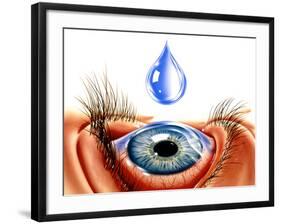 Eye with Conjunctivitis-John Bavosi-Framed Photographic Print