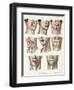 Facial Surgery, Illustration, 1846-Science Source-Framed Giclee Print