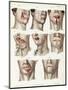 Facial Surgery, Illustration, 1846-Science Source-Mounted Giclee Print