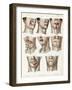 Facial Surgery, Illustration, 1846-Science Source-Framed Giclee Print