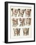 Facial Surgery, Illustration, 1846-Science Source-Framed Giclee Print