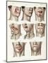 Facial Surgery, Illustration, 1846-Science Source-Mounted Giclee Print