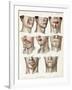 Facial Surgery, Illustration, 1846-Science Source-Framed Giclee Print