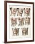 Facial Surgery, Illustration, 1846-Science Source-Framed Giclee Print