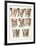Facial Surgery, Illustration, 1846-Science Source-Framed Giclee Print