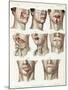Facial Surgery, Illustration, 1846-Science Source-Mounted Giclee Print