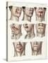 Facial Surgery, Illustration, 1846-Science Source-Stretched Canvas