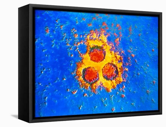 False-col TEM of Varicella-Zoster Virus Particles-null-Framed Stretched Canvas