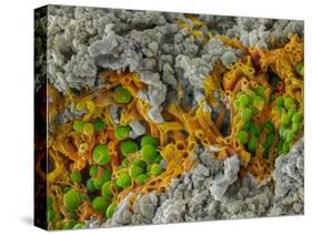 False-coloured SEM of a cleaved sample of crustose lichen-Alex Hyde-Stretched Canvas