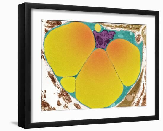 Fat Cell, TEM-Steve Gschmeissner-Framed Photographic Print