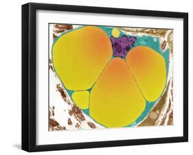 Fat Cell, TEM-Steve Gschmeissner-Framed Photographic Print