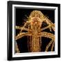 Female Asian Tiger Mosquito-Micro Discovery-Framed Photographic Print