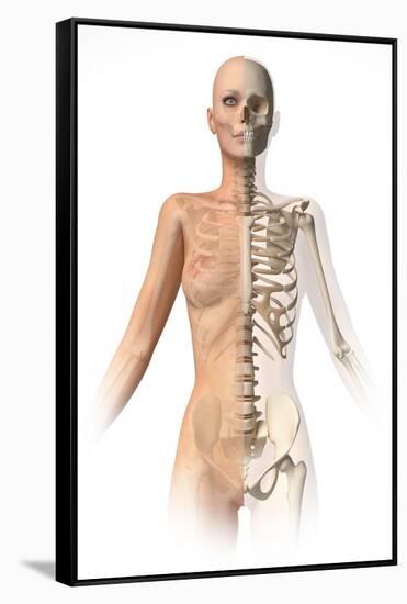 Female Body with Bone Skeleton Superimposed-null-Framed Stretched Canvas
