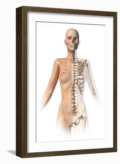 Female Body with Bone Skeleton Superimposed-null-Framed Art Print