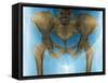 Female Pelvis, X-ray-Du Cane Medical-Framed Stretched Canvas