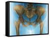 Female Pelvis, X-ray-Du Cane Medical-Framed Stretched Canvas