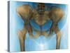 Female Pelvis, X-ray-Du Cane Medical-Stretched Canvas