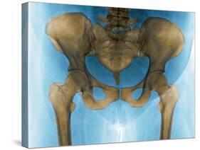 Female Pelvis, X-ray-Du Cane Medical-Stretched Canvas