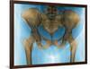 Female Pelvis, X-ray-Du Cane Medical-Framed Photographic Print