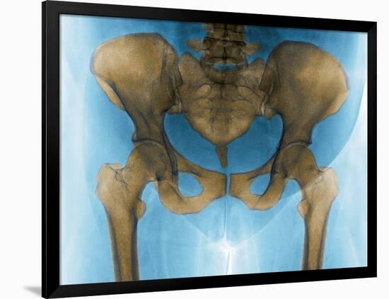 Female Pelvis, X-ray-Du Cane Medical-Framed Photographic Print