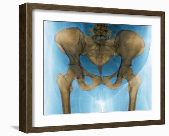 Female Pelvis, X-ray-Du Cane Medical-Framed Photographic Print