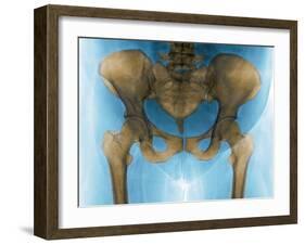 Female Pelvis, X-ray-Du Cane Medical-Framed Photographic Print