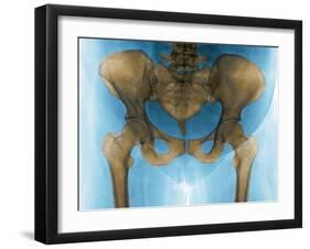 Female Pelvis, X-ray-Du Cane Medical-Framed Photographic Print