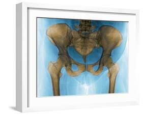 Female Pelvis, X-ray-Du Cane Medical-Framed Photographic Print