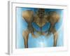 Female Pelvis, X-ray-Du Cane Medical-Framed Photographic Print