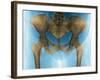 Female Pelvis, X-ray-Du Cane Medical-Framed Photographic Print