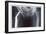 Femur Repair-null-Framed Premium Giclee Print