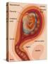Fetus Illustration-Gwen Shockey-Stretched Canvas