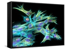 Fibroblast Cells, Fluorescent Micrograph-Dr. Torsten Wittmann-Framed Stretched Canvas